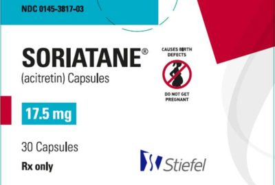 Soriatane (Acitretin) Wholesale